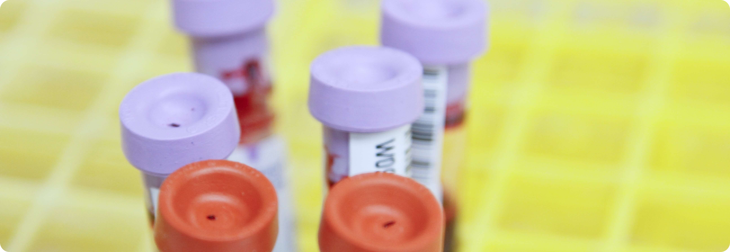 A group of different colored bottles.
