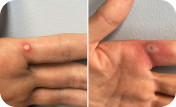 Close-up of a person's hand.