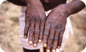 A close-up of hands.